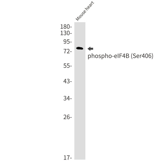 Phospho-eIF4B (Ser406) Rabbit Monoclonal Antibody