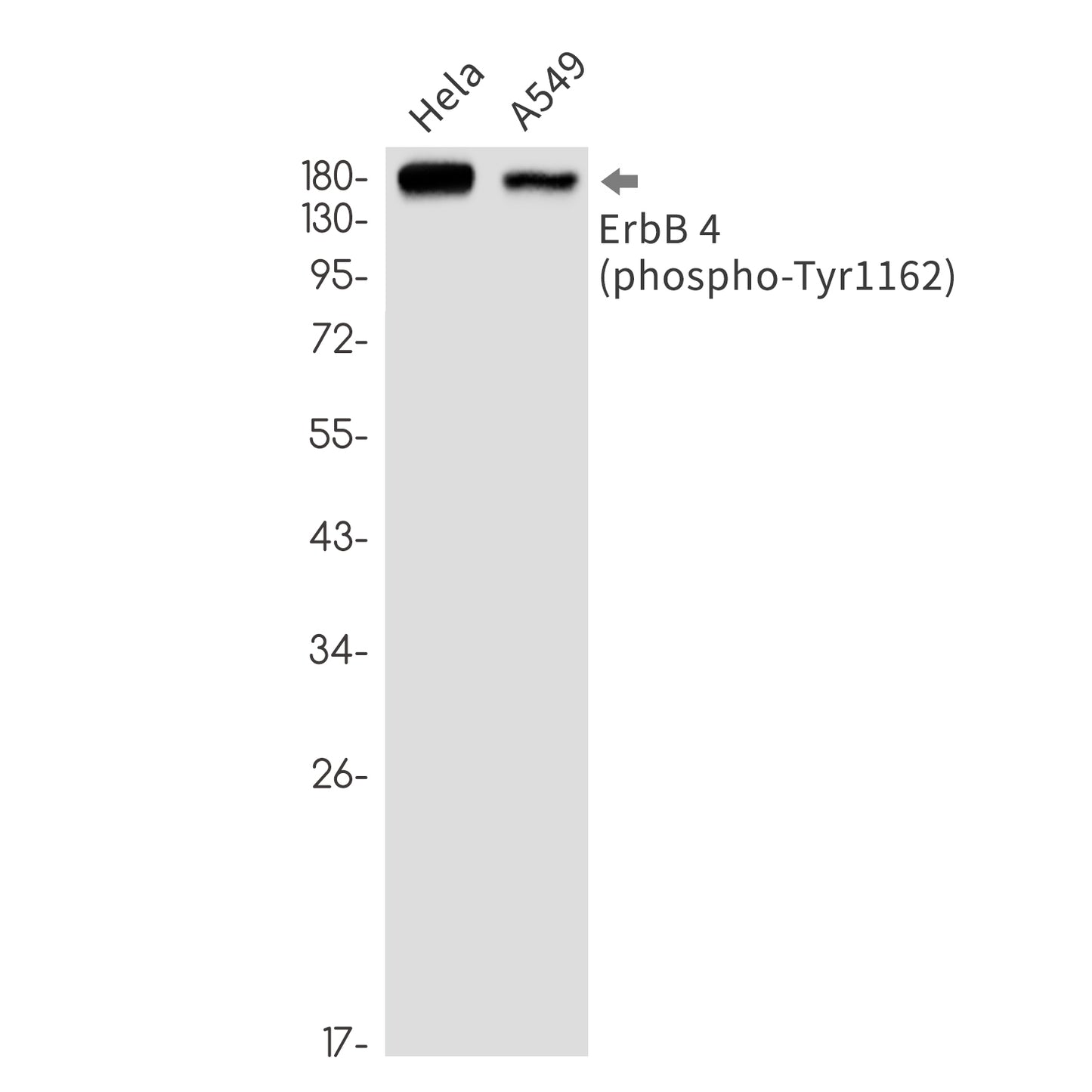 Phospho-ErbB 4 (Tyr1162) Rabbit Monoclonal Antibody