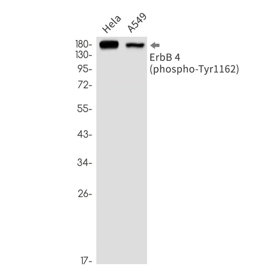 Phospho-ErbB 4 (Tyr1162) Rabbit Monoclonal Antibody