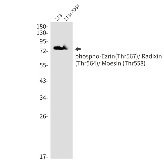Phospho-Ezrin/Radixin/Moesin (Thr567/Thr564/Thr558) Rabbit Monoclonal Antibody