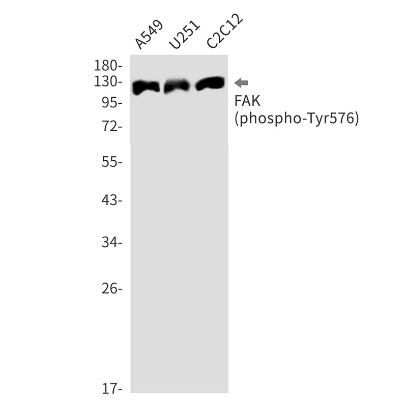 Phospho-FAK (Tyr576) Rabbit Monoclonal Antibody