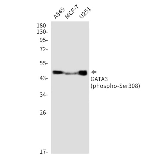Phospho-GATA3 (Ser308) Rabbit Monoclonal Antibody