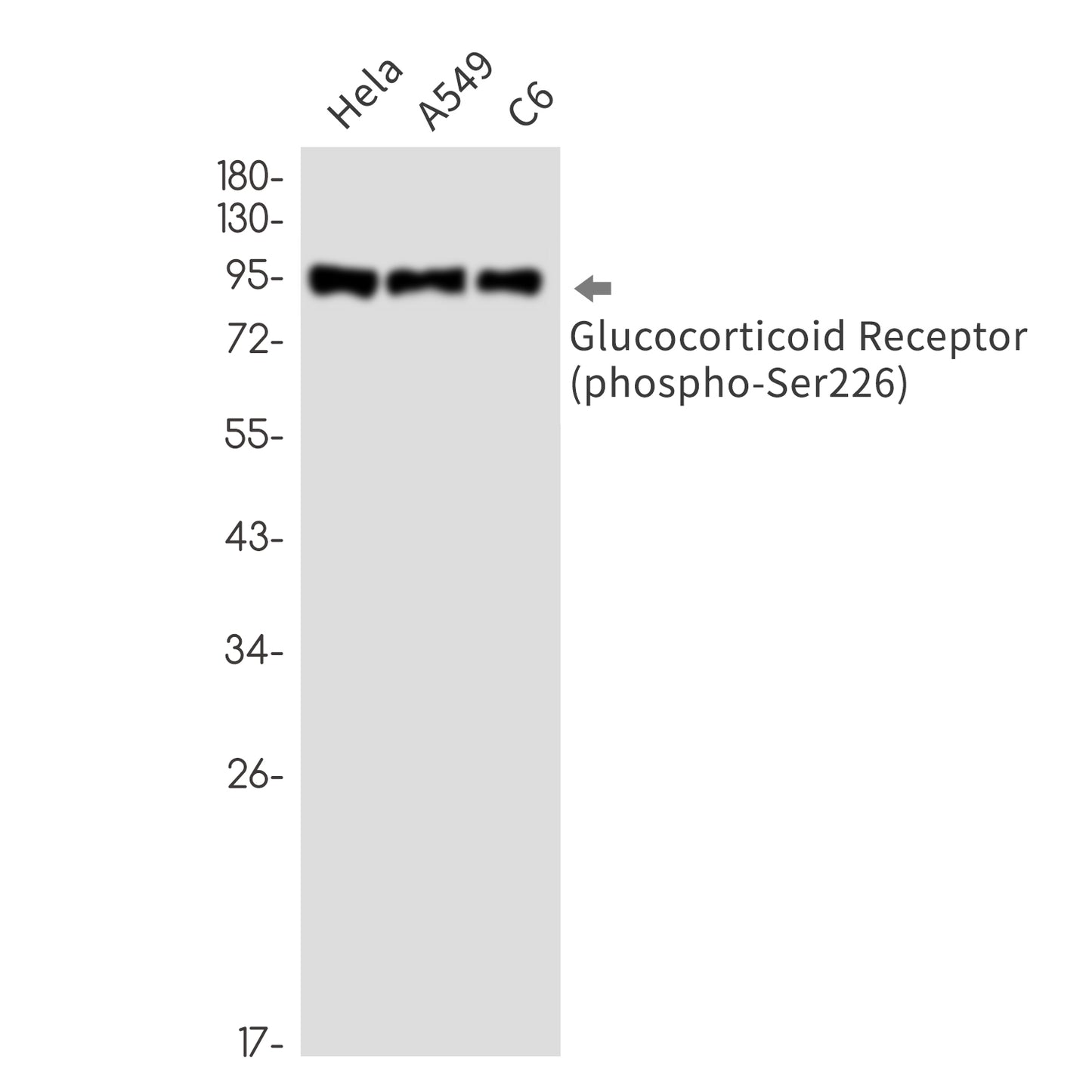 Phospho-Glucocorticoid Receptor (Ser226) Rabbit Monoclonal Antibody