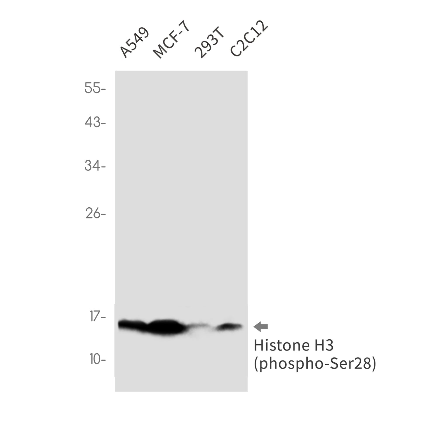 Phospho-Histone H3 (Ser28) Rabbit Monoclonal Antibody