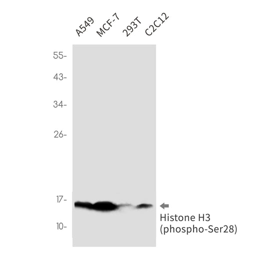 Phospho-Histone H3 (Ser28) Rabbit Monoclonal Antibody