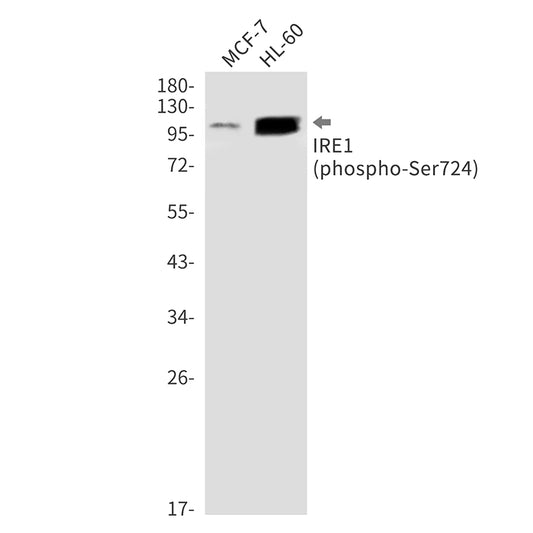 Phospho-IRE1 (Ser724) Rabbit Monoclonal Antibody