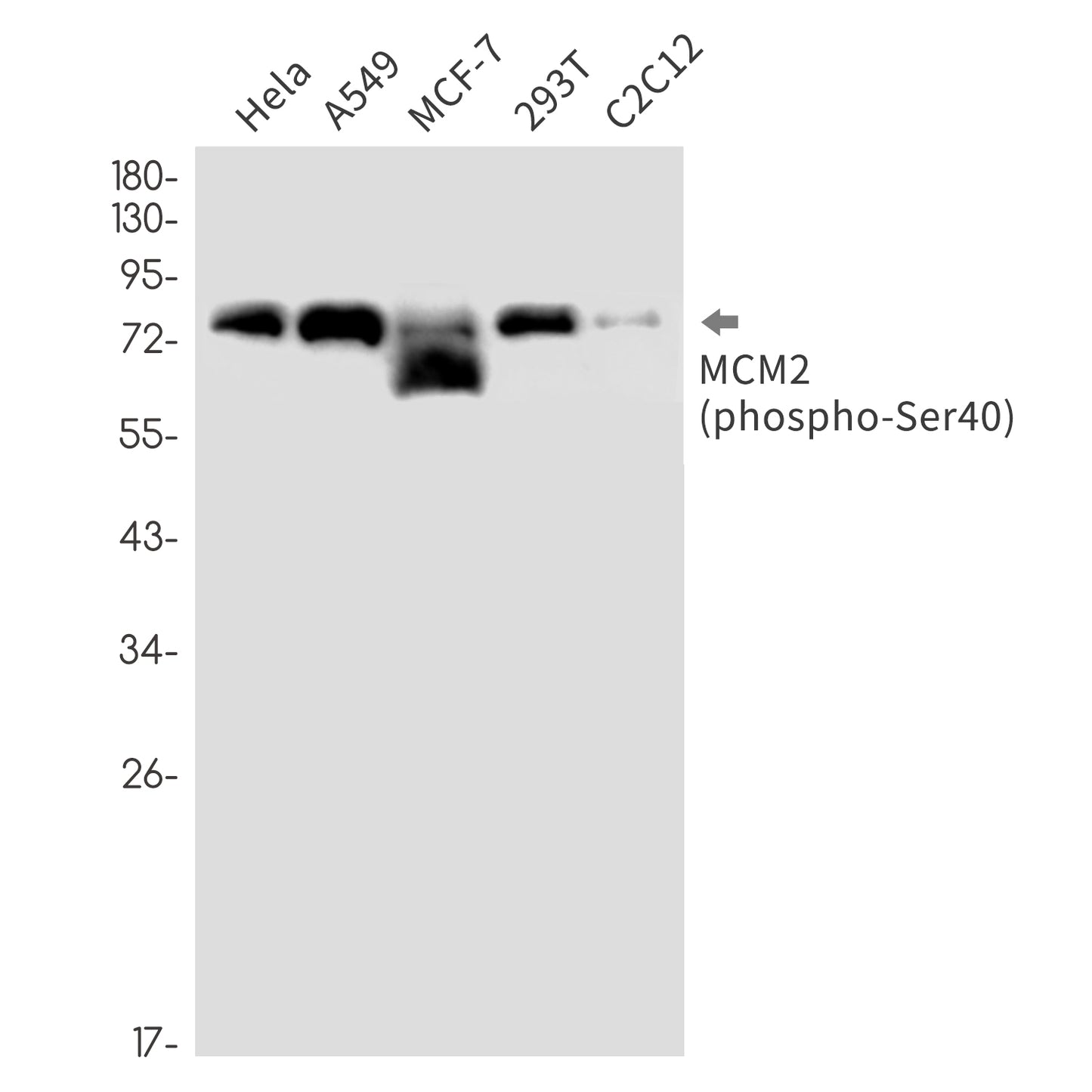 Phospho-MCM2 (Ser40) Rabbit Monoclonal Antibody