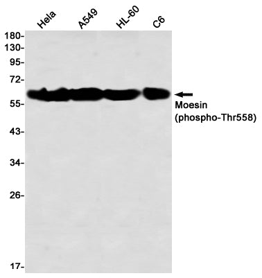 Phospho-Moesin (Thr558) Rabbit Monoclonal Antibody