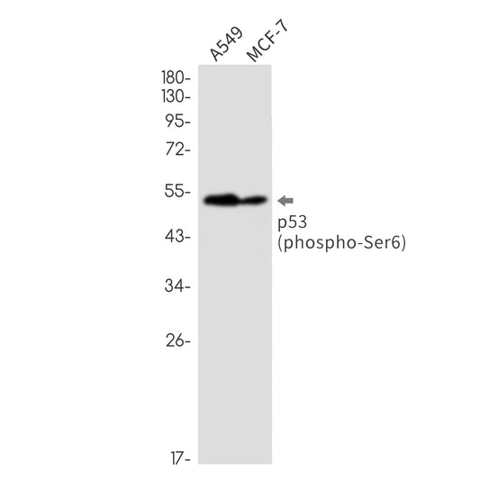 Phospho-p53 (Ser6) Rabbit Monoclonal Antibody