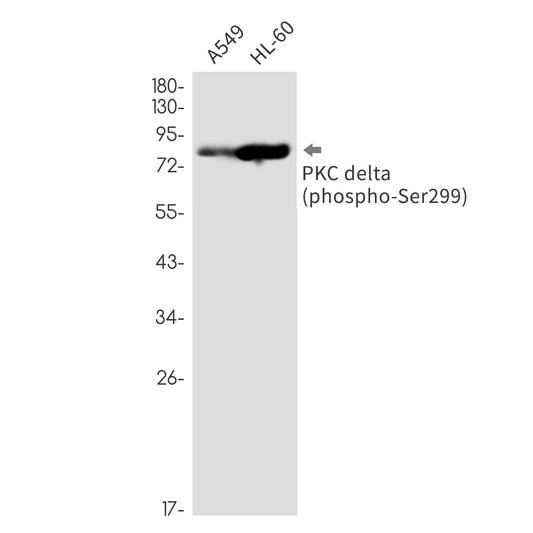 Phospho-PKC delta (Ser299) Rabbit Monoclonal Antibody