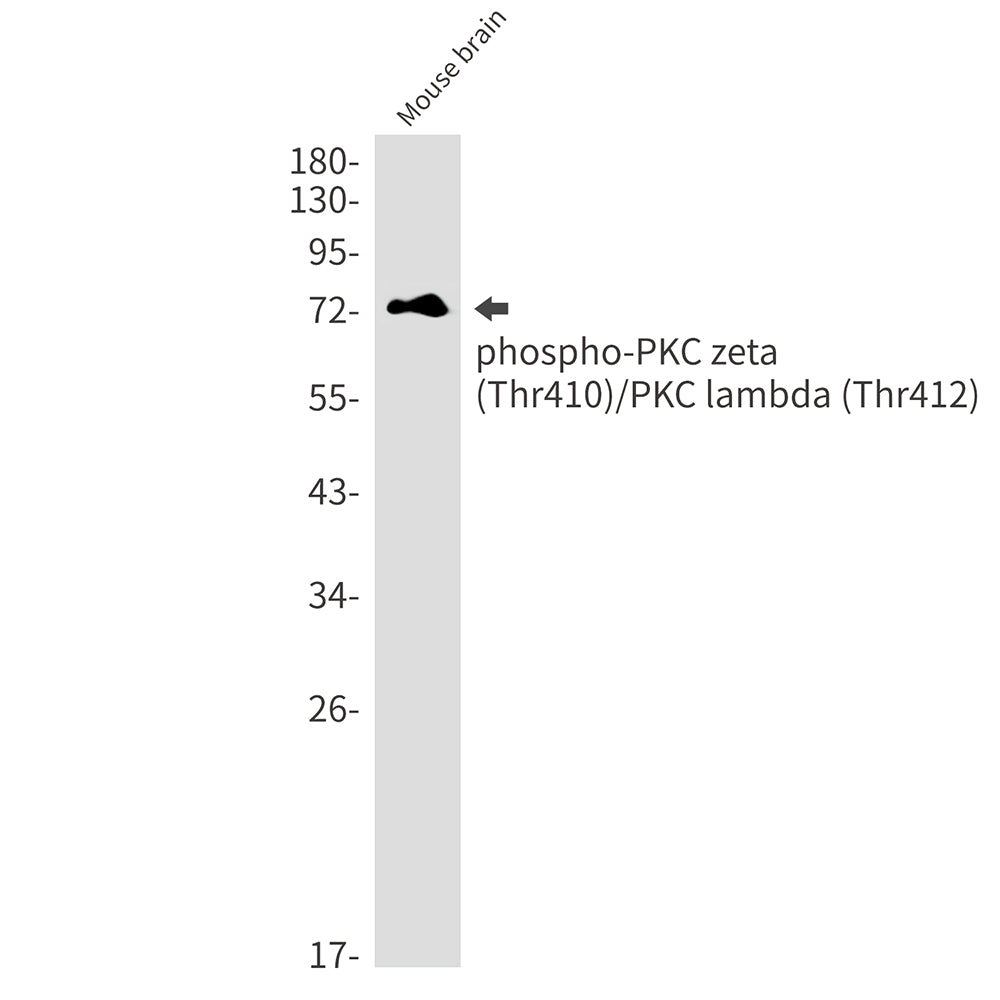 Phospho-PKC zeta/lambda (Thr410/Thr412) Rabbit Monoclonal Antibody