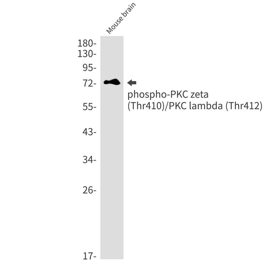 Phospho-PKC zeta/lambda (Thr410/Thr412) Rabbit Monoclonal Antibody