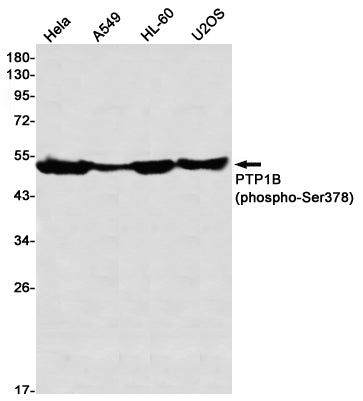 Phospho-PTP1B (Ser378) Rabbit Monoclonal Antibody