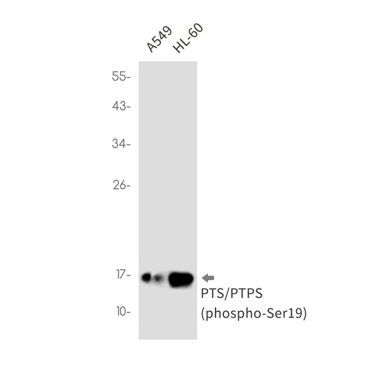 Phospho-PTS (Ser19) Rabbit Monoclonal Antibody