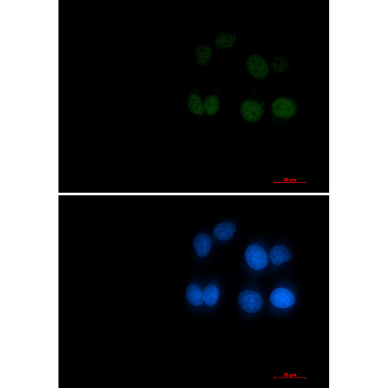 Phospho-Rad17 (Ser656) Rabbit Monoclonal Antibody