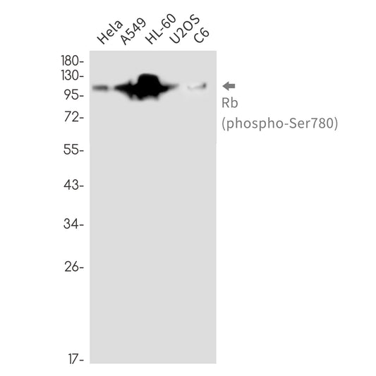 Phospho-Rb (Ser780) Rabbit Monoclonal Antibody