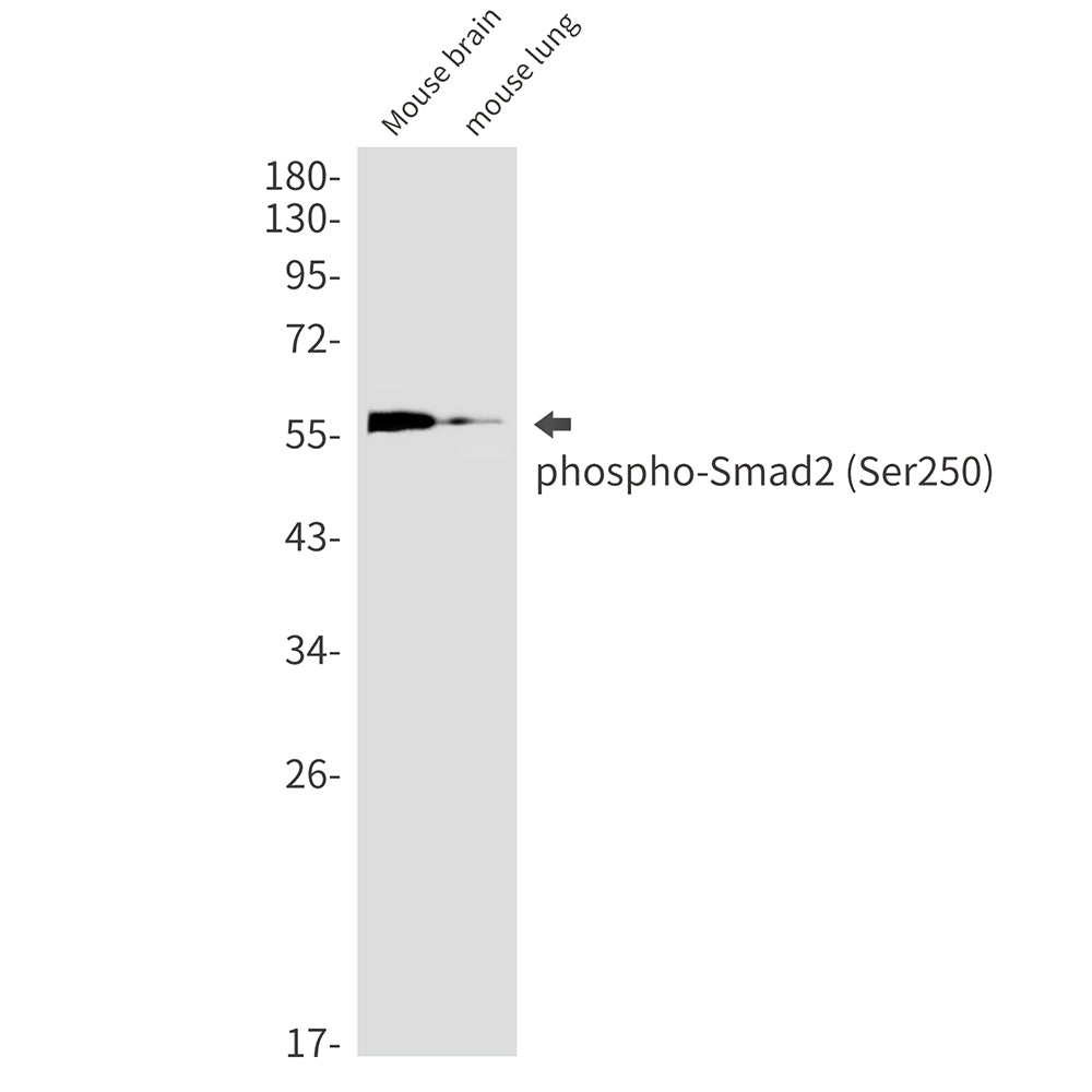 Phospho-Smad2 (Ser250) Rabbit Monoclonal Antibody