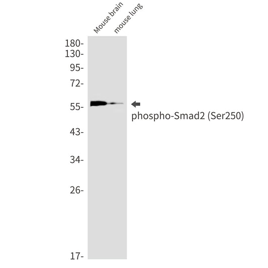 Phospho-Smad2 (Ser250) Rabbit Monoclonal Antibody