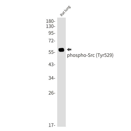 Phospho-Src (Tyr530) Rabbit Monoclonal Antibody