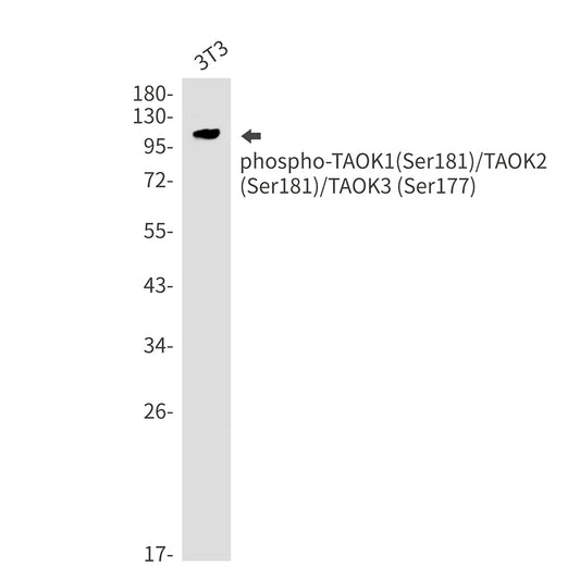 Phospho-TAOK1/2/3 (Ser181/Ser181/Ser177) Rabbit Monoclonal Antibody