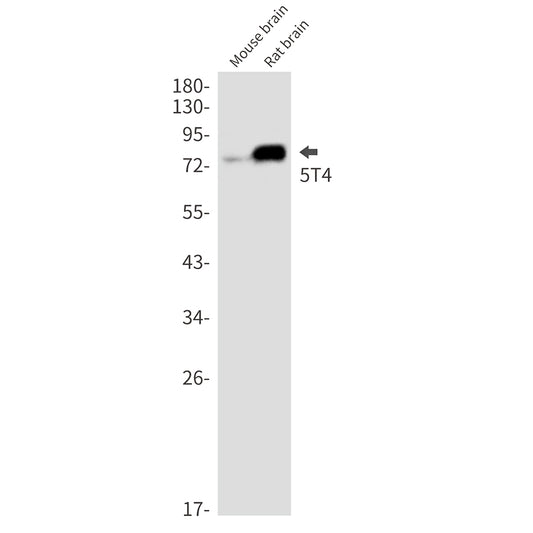 5T4 Rabbit Monoclonal Antibody