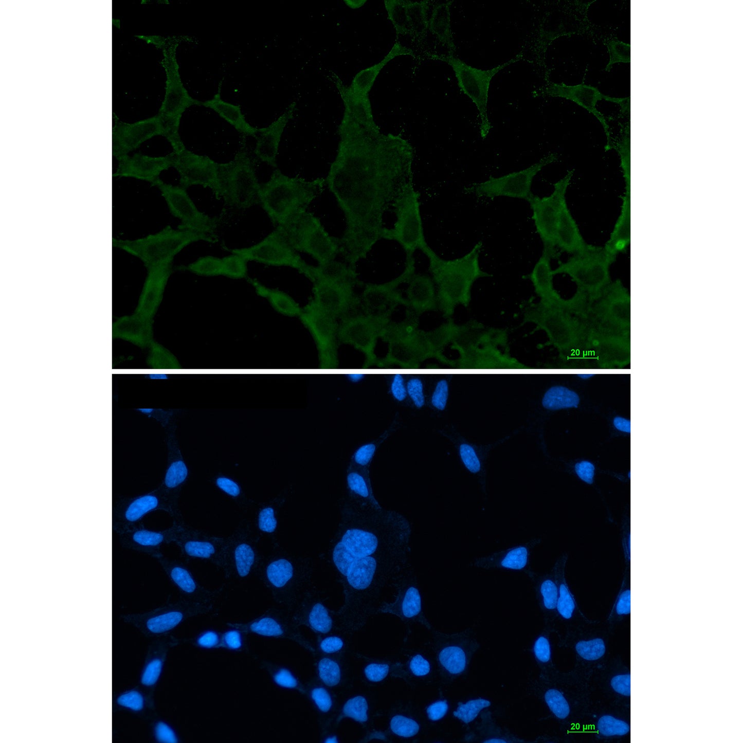ACADM Rabbit Monoclonal Antibody