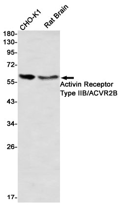Activin Receptor Type IIB Rabbit Monoclonal Antibody