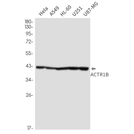 ACTR1B Rabbit Monoclonal Antibody