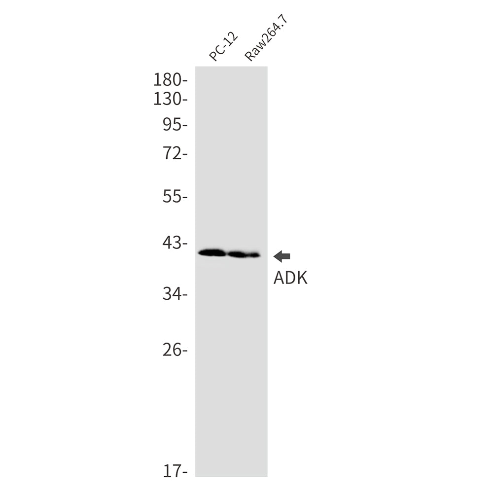 ADK Rabbit Monoclonal Antibody