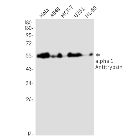 alpha 1-Antitrypsin Rabbit Monoclonal Antibody