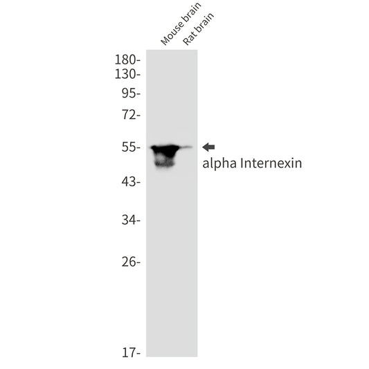 alpha Internexin Rabbit Monoclonal Antibody