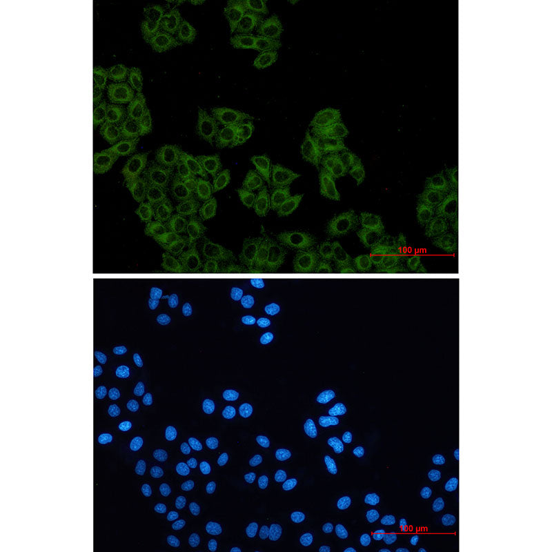 Actin Related Protein 2 Rabbit Monoclonal Antibody