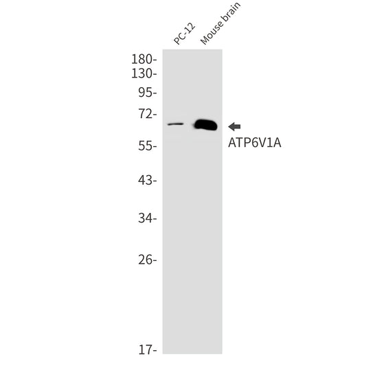 ATP6V1A Rabbit Monoclonal Antibody
