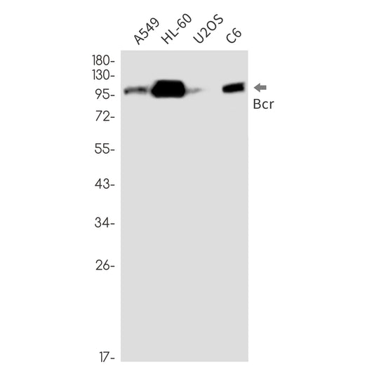 Bcr Rabbit Monoclonal Antibody