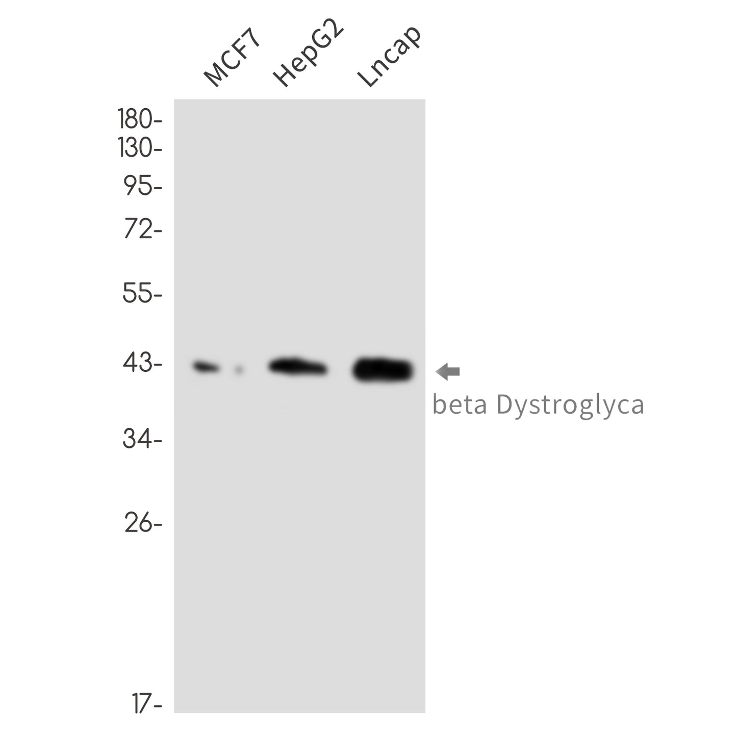 beta Dystroglycan Rabbit Monoclonal Antibody