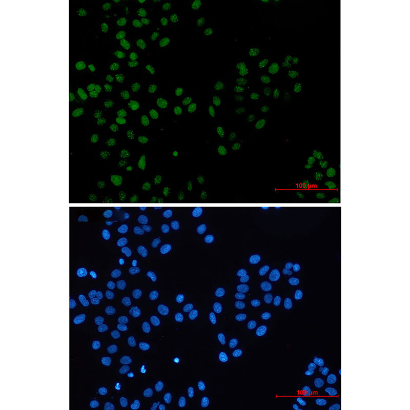 BMI1 Rabbit Monoclonal Antibody