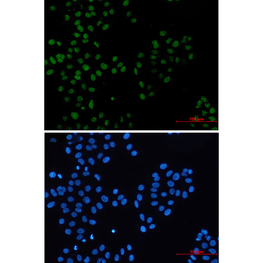 BMI1 Rabbit Monoclonal Antibody