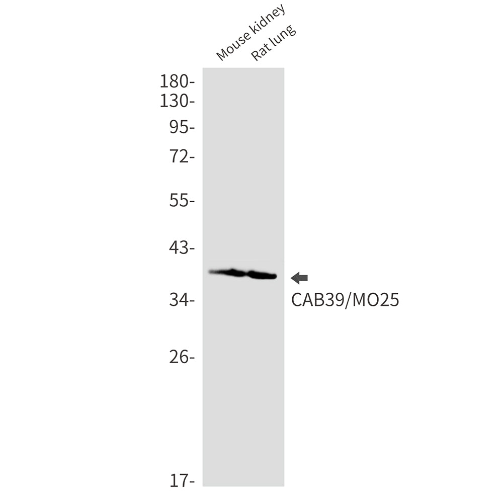 CAB39 Rabbit Monoclonal Antibody