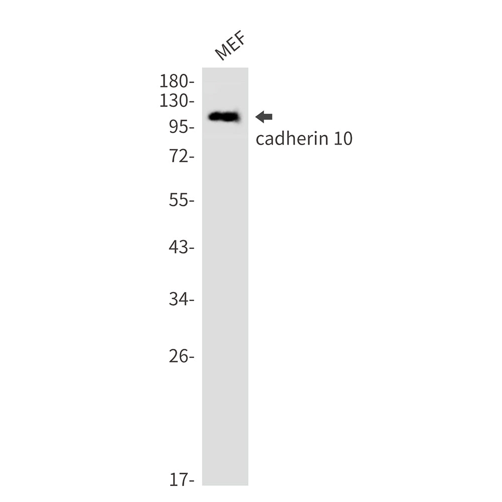 Cadherin 10 Rabbit Monoclonal Antibody