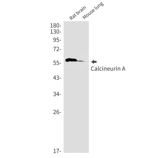 Calcineurin A Rabbit Monoclonal Antibody