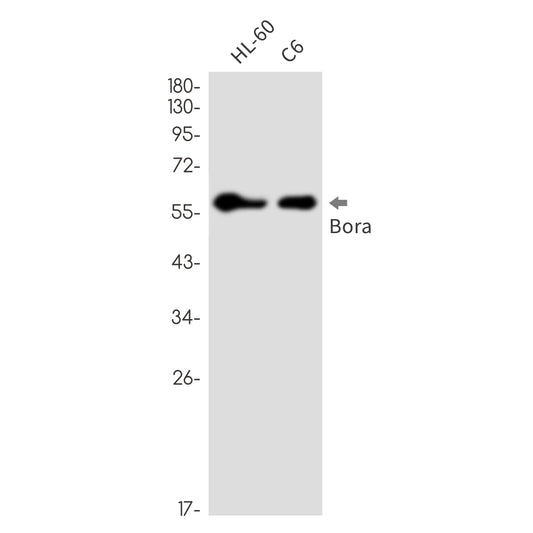 Caldesmon Rabbit Monoclonal Antibody