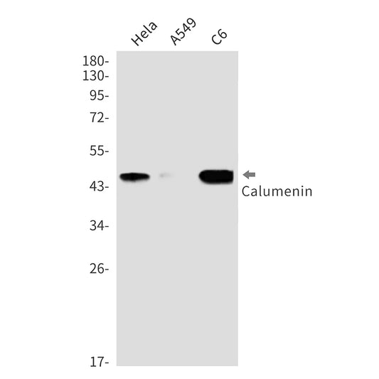 Calumenin Rabbit Monoclonal Antibody