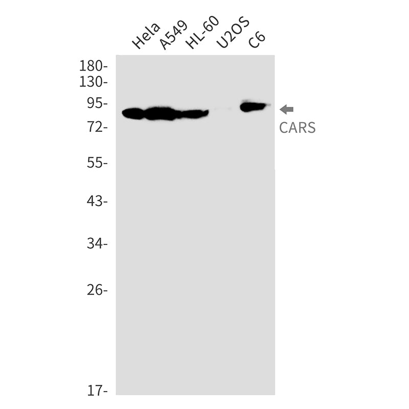 CARS Rabbit Monoclonal Antibody