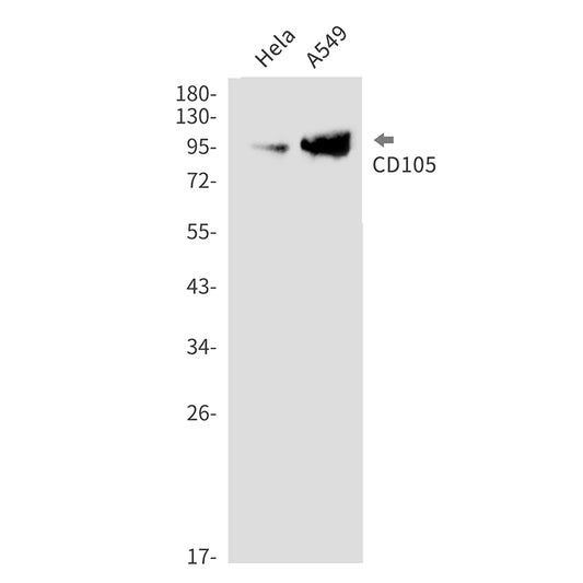 CD105 Rabbit Monoclonal Antibody