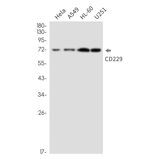 CD229 Rabbit Monoclonal Antibody