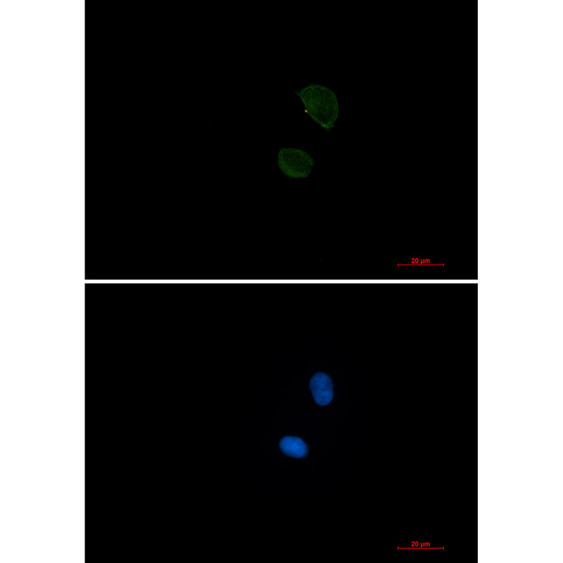 CD99 Rabbit Monoclonal Antibody