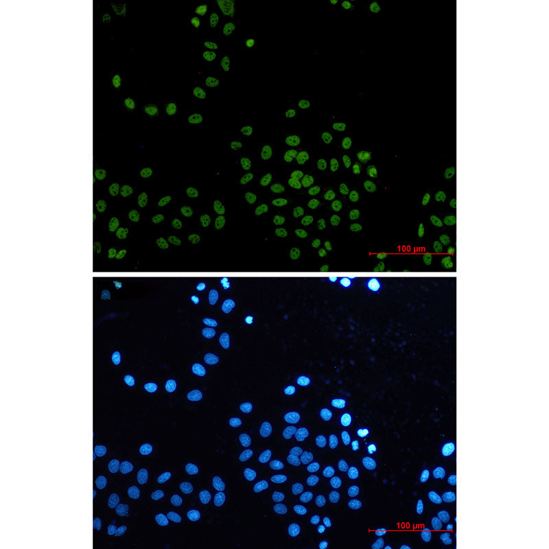 CDK9 Rabbit Monoclonal Antibody