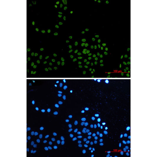 CDK9 Rabbit Monoclonal Antibody