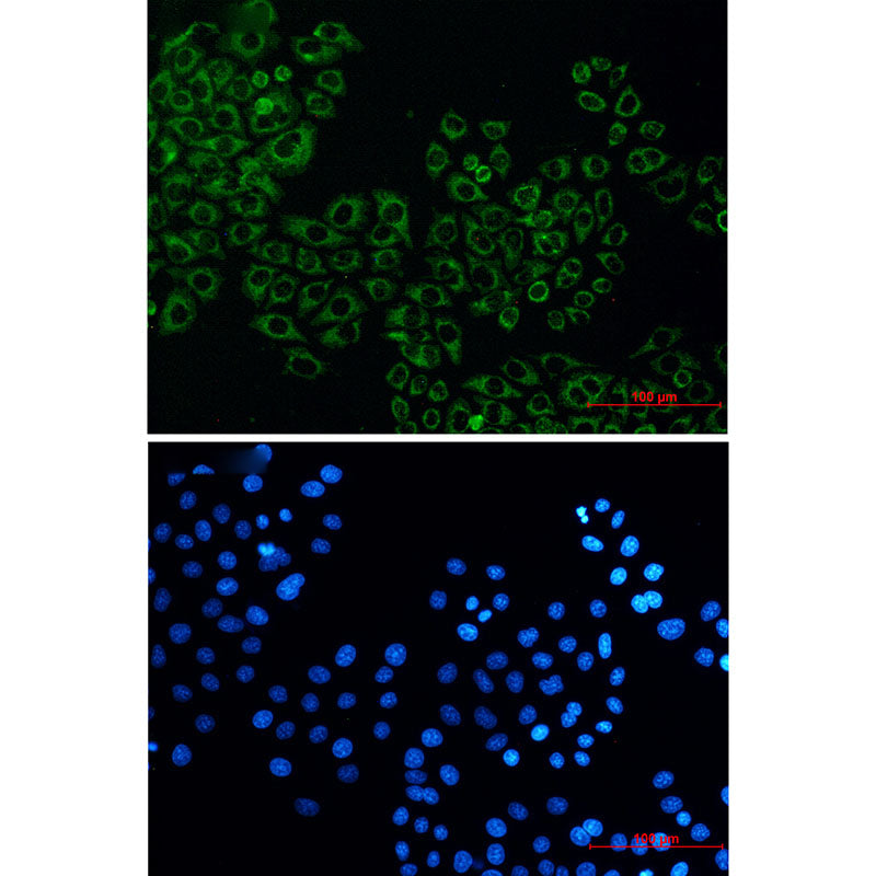 Citrate Synthetase Rabbit Monoclonal Antibody