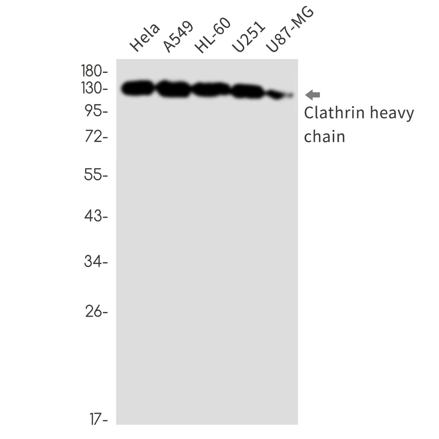 Clathrin Heavy Chain Rabbit Monoclonal Antibody